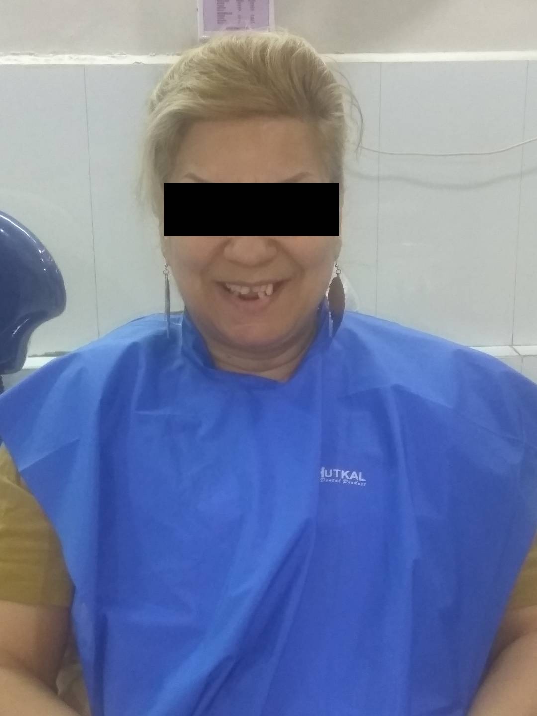 Pediatric dentistry in pune