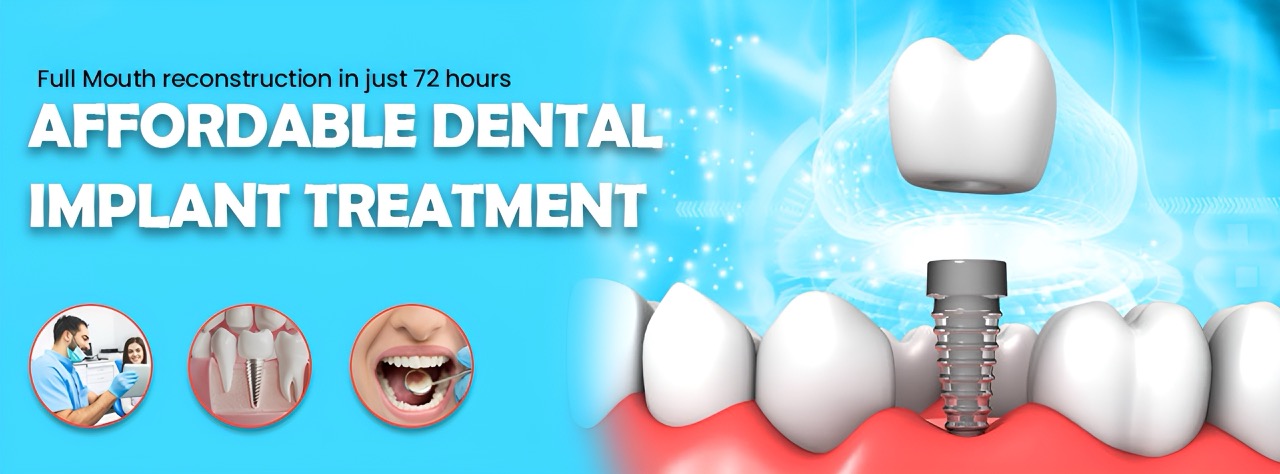 implants in pune, Laxmi road, Camp