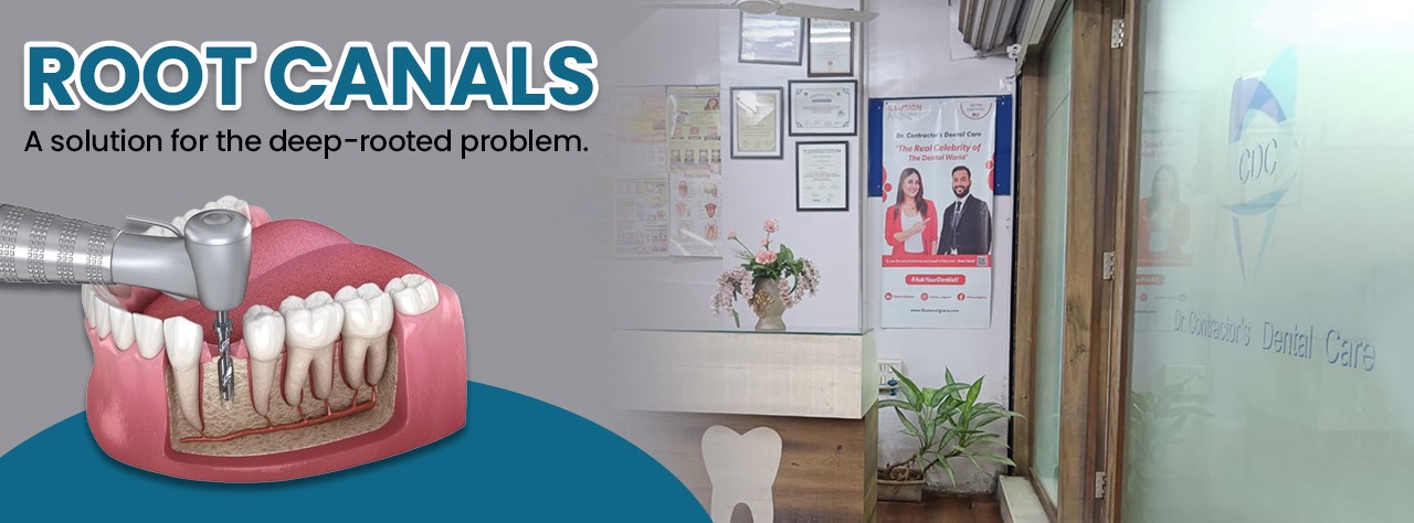  best Aligners in champ