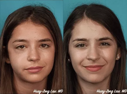 best Facial Bone Fracture Treatment in pune, Laxmi road, Camp