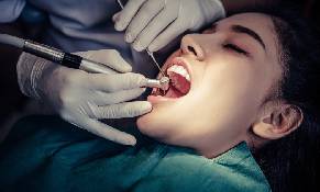 best Root canals treatments in pune, Laxmi road, Camp